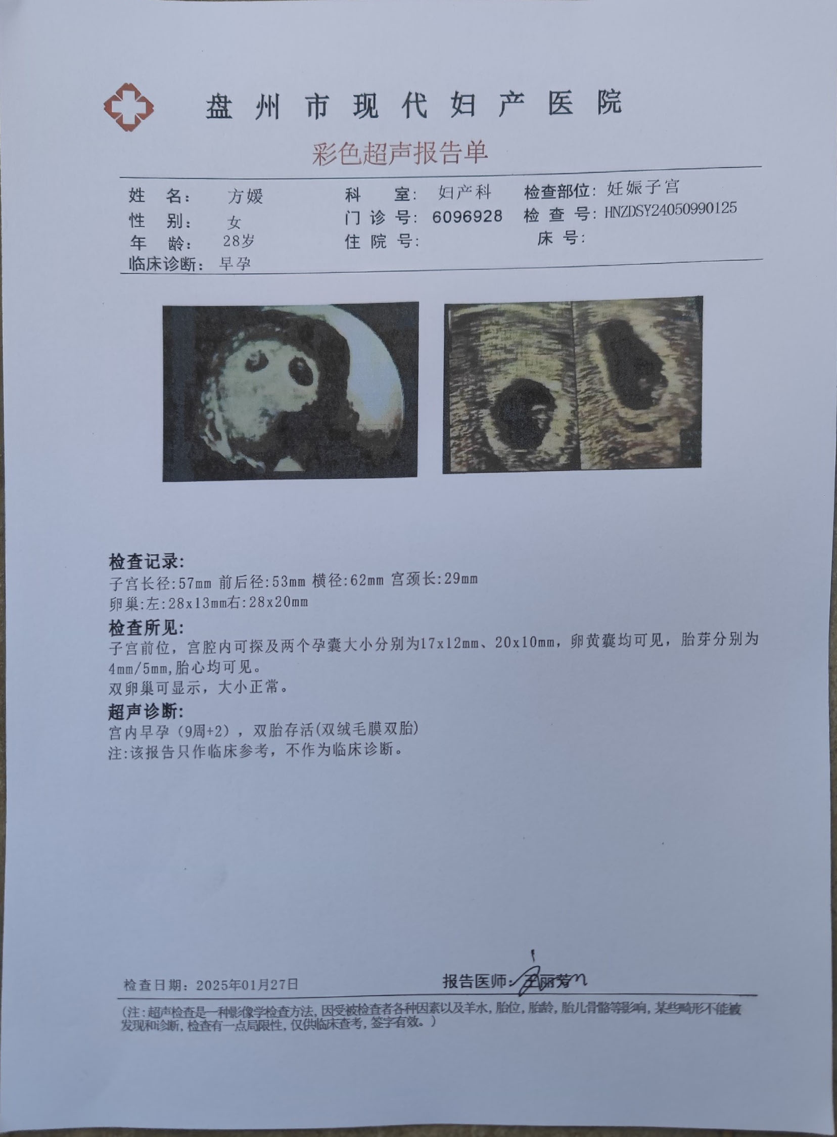 怀孕b超单图片在线生成